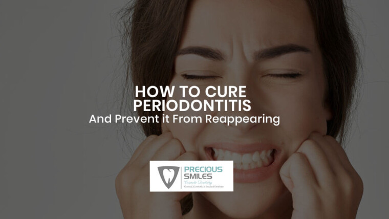 How to Cure Periodontitis And Prevent it From Reappearing