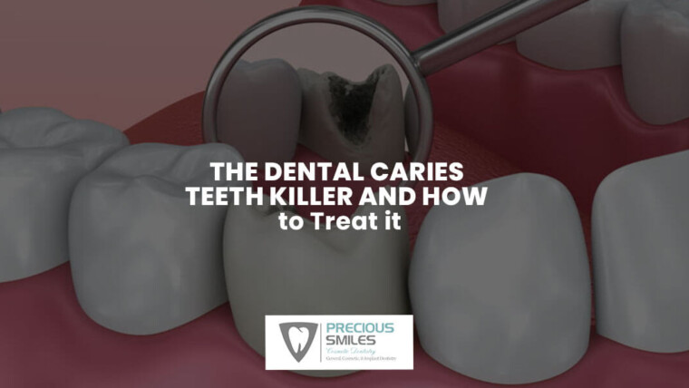The Dental Caries – Teeth Killer and How to Treat it.