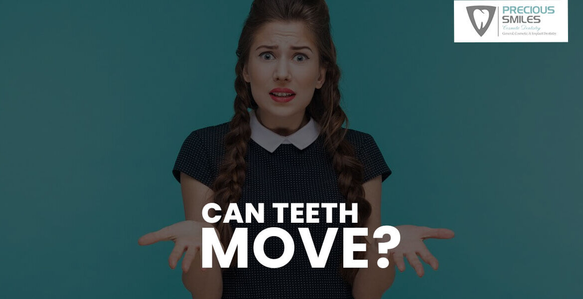 Can Teeth move