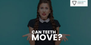 Read more about the article Can Teeth move