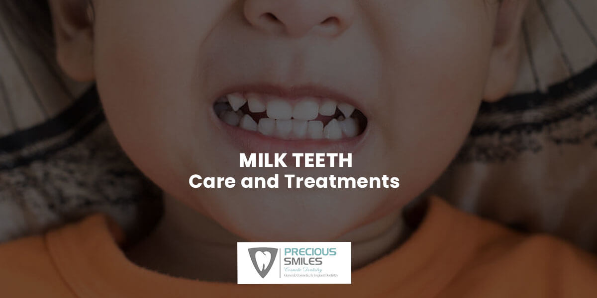 You are currently viewing Milk teeth – Care and Treatments