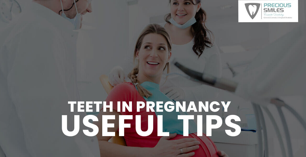 Teeth in Pregnancy – Useful Tips