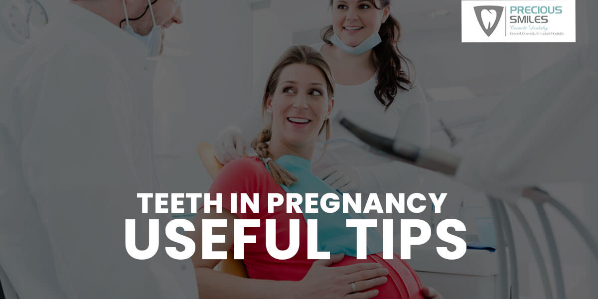 Teeth in pregnancy, Useful tips