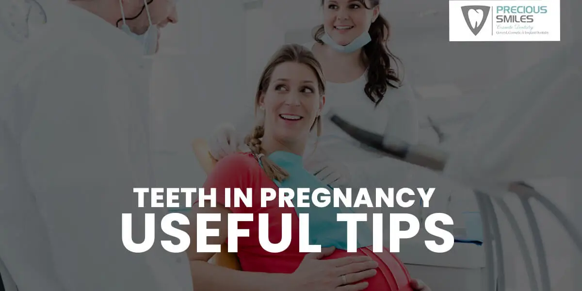 Teeth in pregnancy, Useful tips