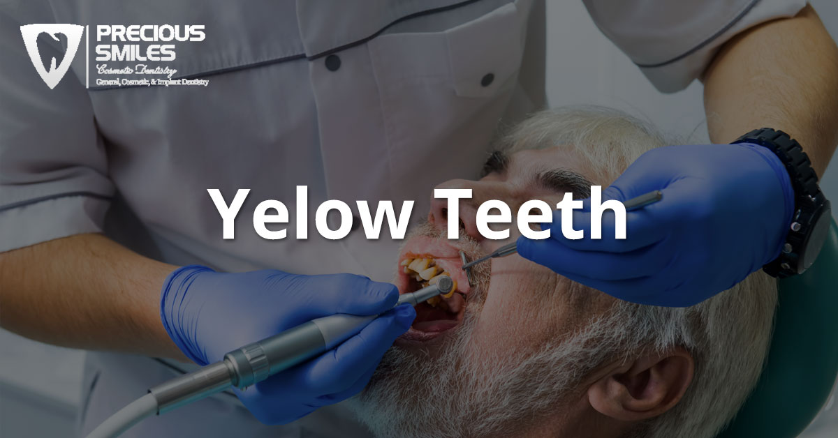 You are currently viewing Yellow Teeth