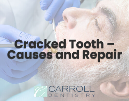 Cracked Tooth – Causes and Repair