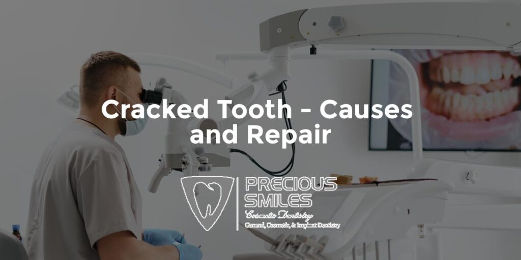 Cracked Tooth Causes And Repair Precious Smiles