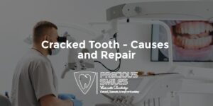 Read more about the article Cracked Tooth – Causes and Repair