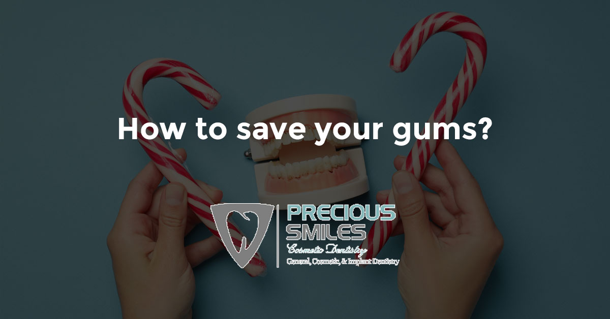 You are currently viewing How to save your gums?