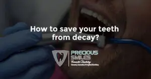Read more about the article How to save your teeth from decay?