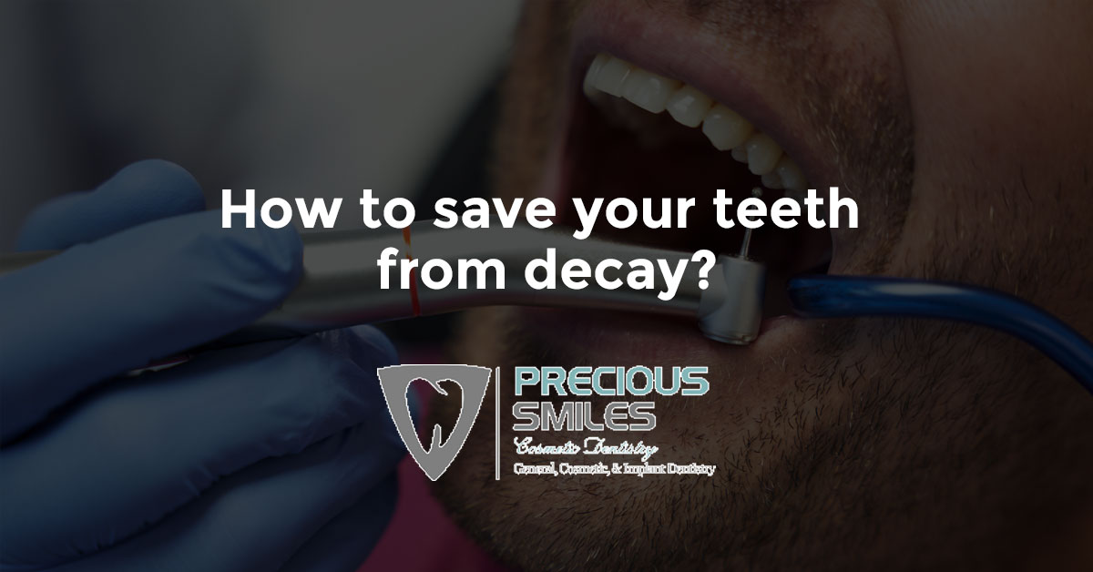 You are currently viewing How to save your teeth from decay?
