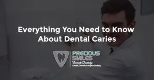 Read more about the article Everything You Need to Know About Dental Caries