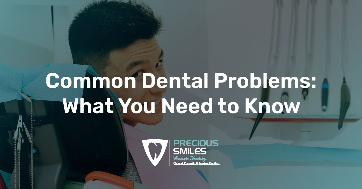 You are currently viewing Common Dental Problems: What You Need to Know