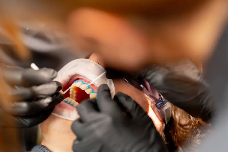 Gum Disease