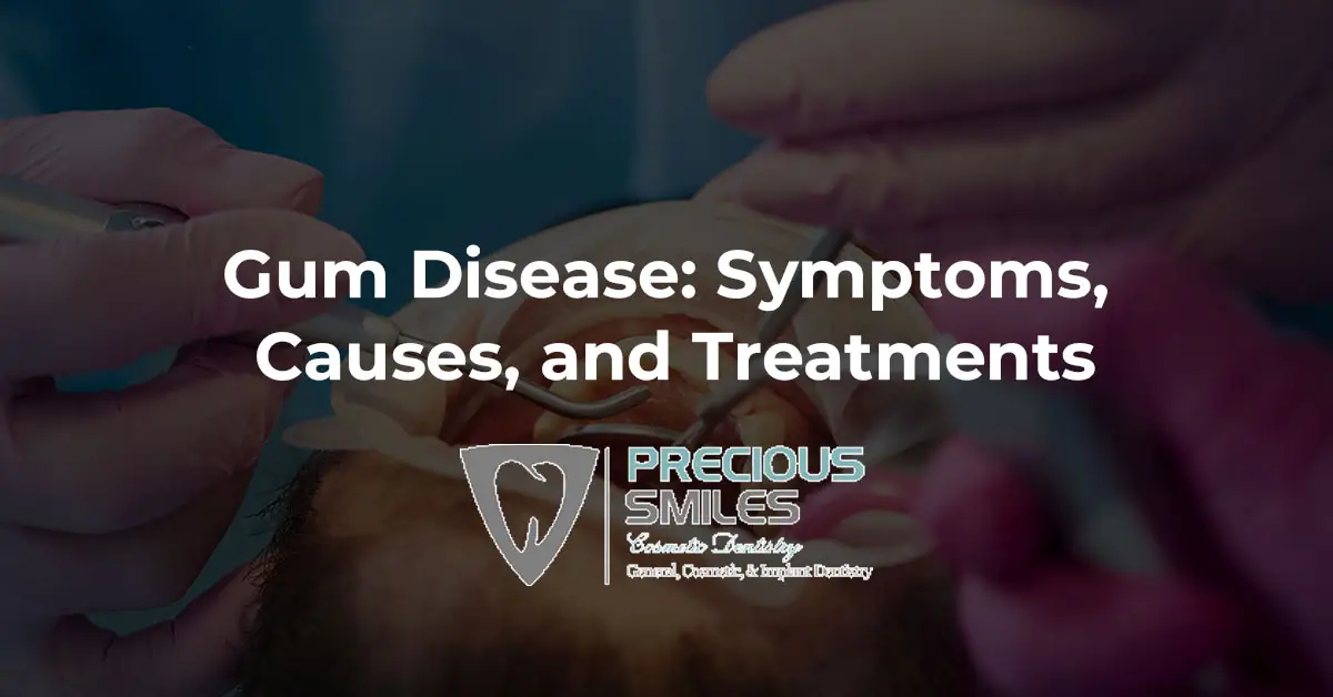 You are currently viewing Gum Disease: Symptoms, Causes, and Treatments