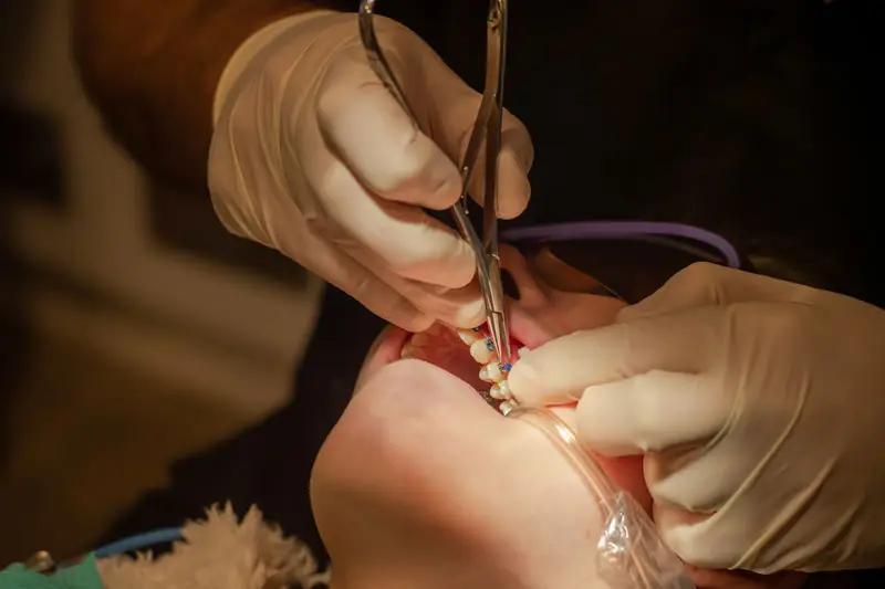 Visit Your Dentist