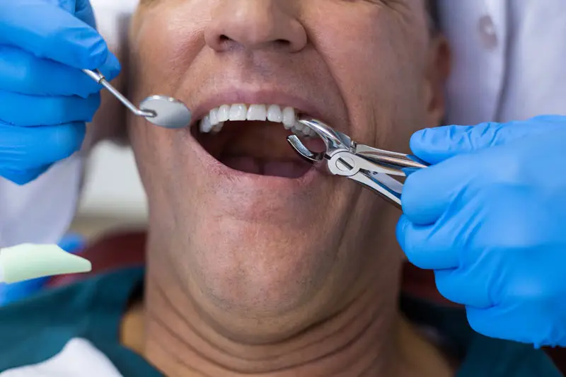 cavities