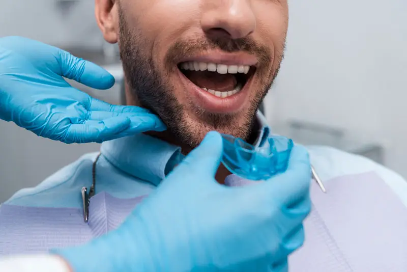 teeth whitening