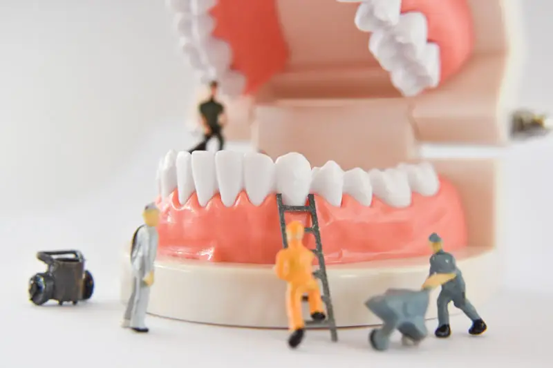 Laser Dentistry