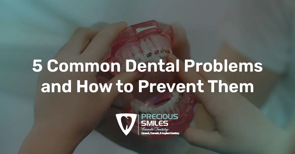 You are currently viewing 5 Common Dental Problems and How to Prevent Them