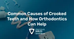 Read more about the article Common Causes of Crooked Teeth and How Orthodontics Can Help