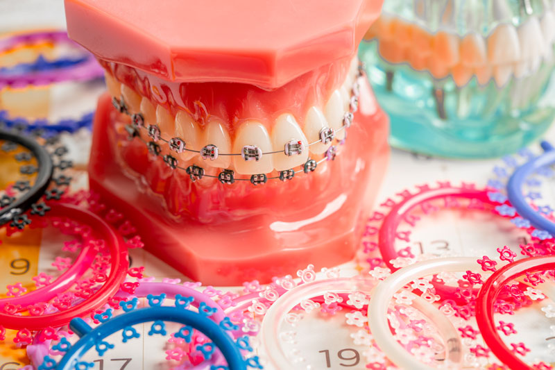 orthodontic consultation