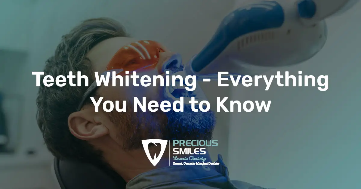 You are currently viewing Teeth Whitening – Everything You Need to Know Before the Treatment