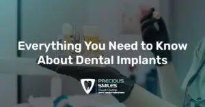 Read more about the article Dental Implants – Everything You Need to Know Before Getting Them